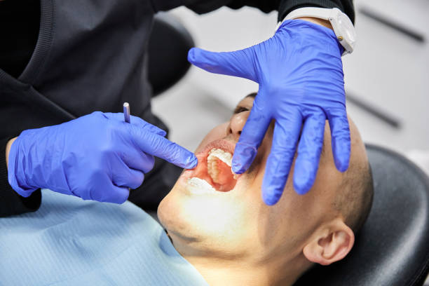 Best Emergency Wisdom Teeth Removal in Addison, TX